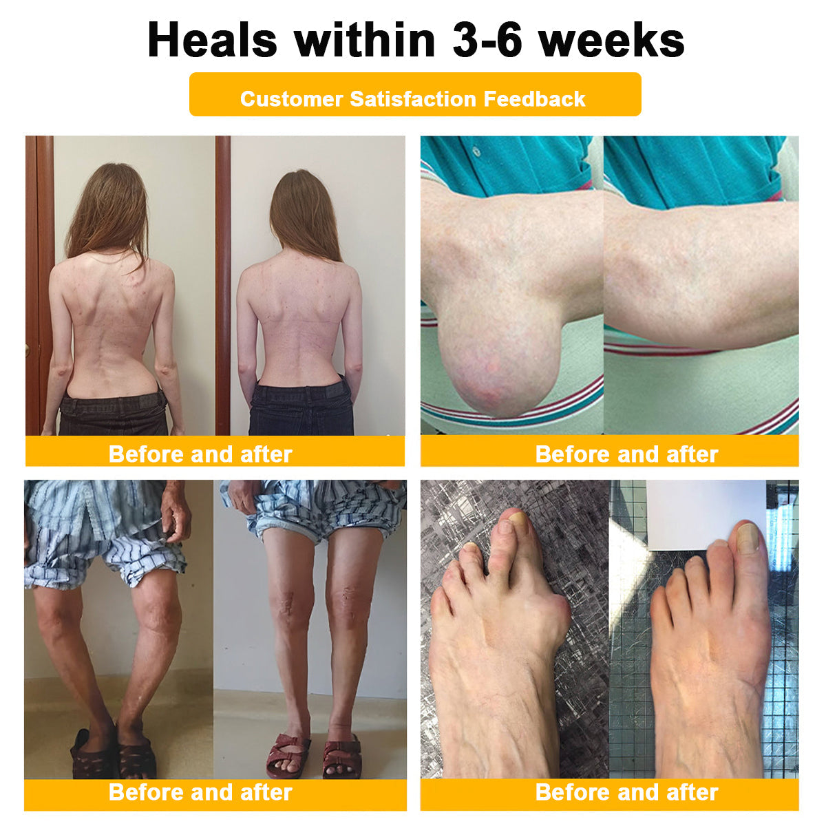 🔥Final 3 Hours: 80% OFF - ODALIT™ Botulinum Toxin & Bee Venom Pain-Relief Bone Healing Cream🐝