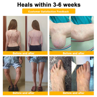 🔥Final 3 Hours: 80% OFF - ODALIT™ Botulinum Toxin & Bee Venom Pain-Relief Bone Healing Cream🐝