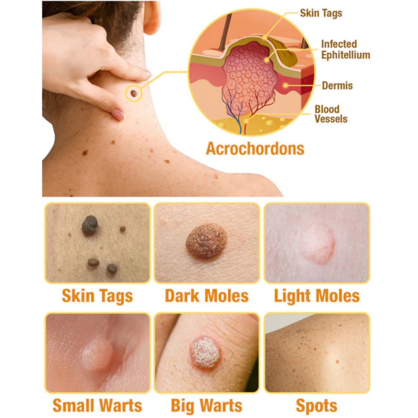 LBMLBM™ TagRecede Bee Venom Treatment Spray