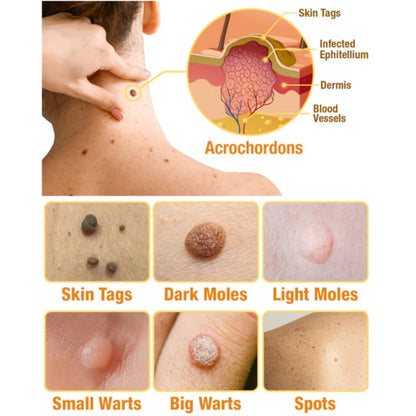 LBMLBM™ TagRecede Bee Venom Treatment Spray