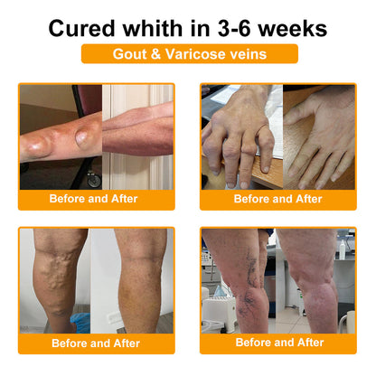 🔥Final 3 Hours: 80% OFF - ODALIT™ Botulinum Toxin & Bee Venom Pain-Relief Bone Healing Cream🐝