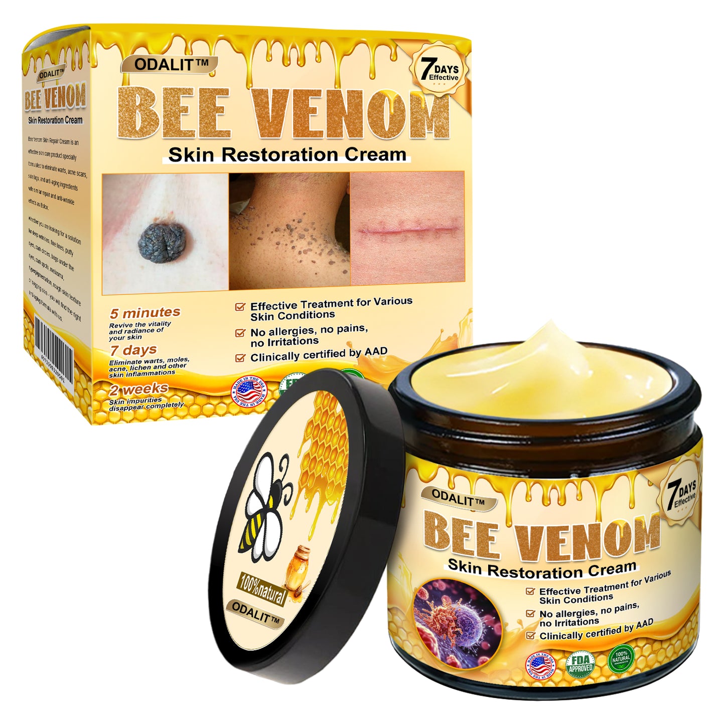 🔥Final 3 Hours: 80% OFF - ODALIT™ Bee Venom Skin Restoration Cream🐝