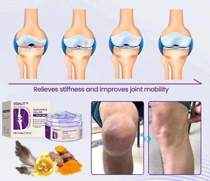 🔥Final 3 Hours: 80% OFF - ODALIT™ Curcumin & Emu Oil Pain Gel – 🏥Backed by US Osteopathic Experts