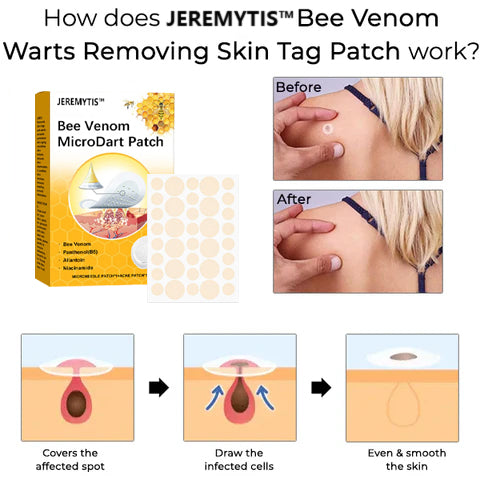 JEREMYTIS™ Bee Venom MicroDart Patch