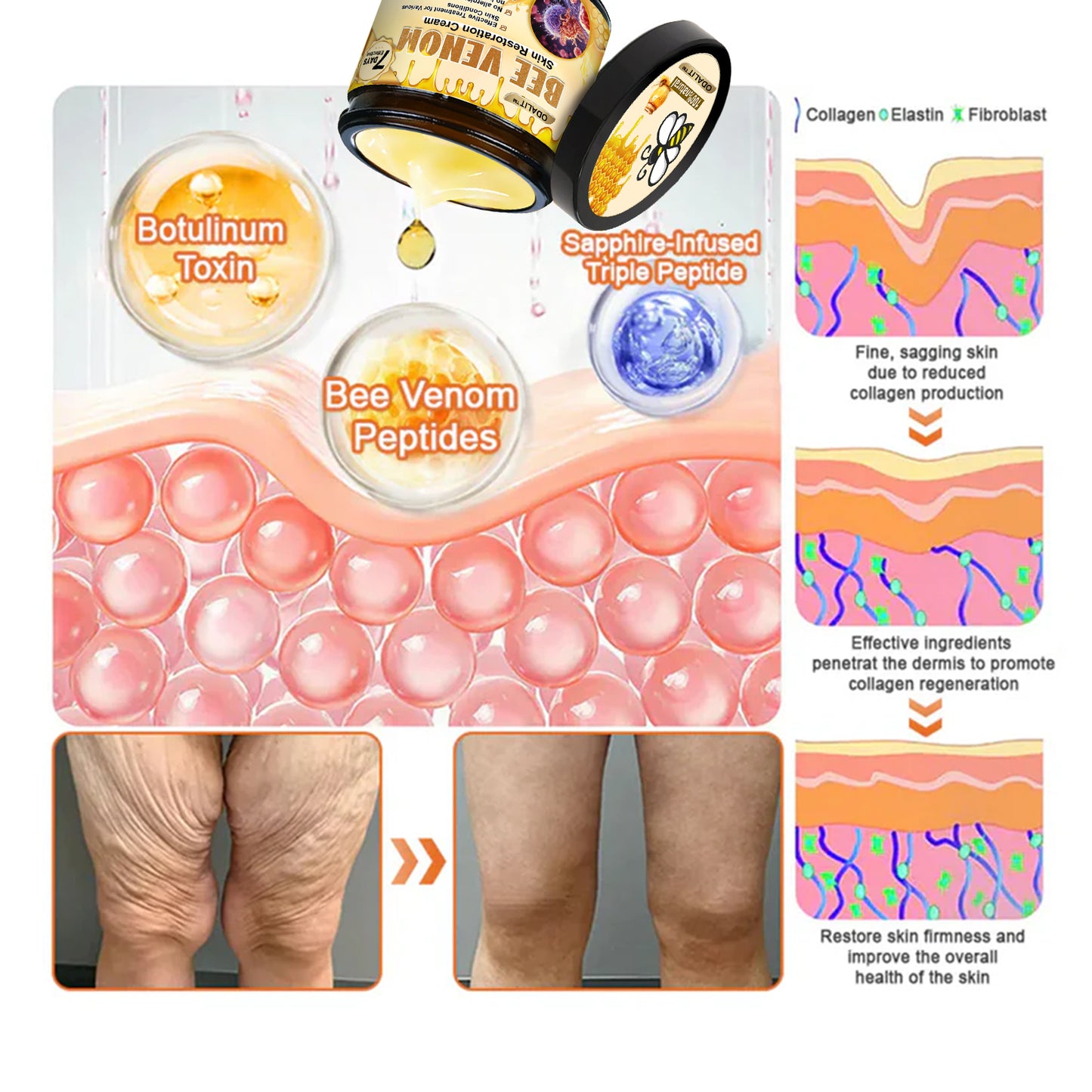 🔥Final 3 Hours: 80% OFF - ODALIT™ Bee Venom Skin Restoration Cream🐝