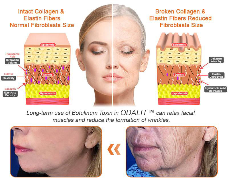 🔥Final 3 Hours: 80% OFF - ODALIT™ Bee Venom Skin Restoration Cream🐝