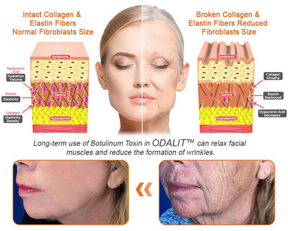 🔥Final 3 Hours: 80% OFF - ODALIT™ Bee Venom Skin Restoration Cream🐝