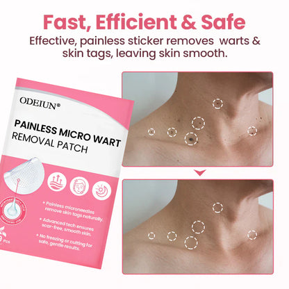 ODEIUN® Painless Micro Wart Removal Patch