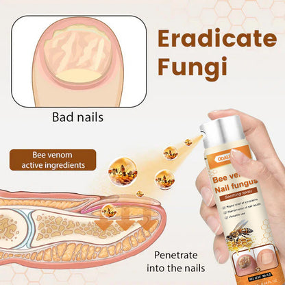 🔥Final 3 Hours: 80% OFF - ODALIT™ Bee Venom Nail Fungus Soothing Spray 🐝