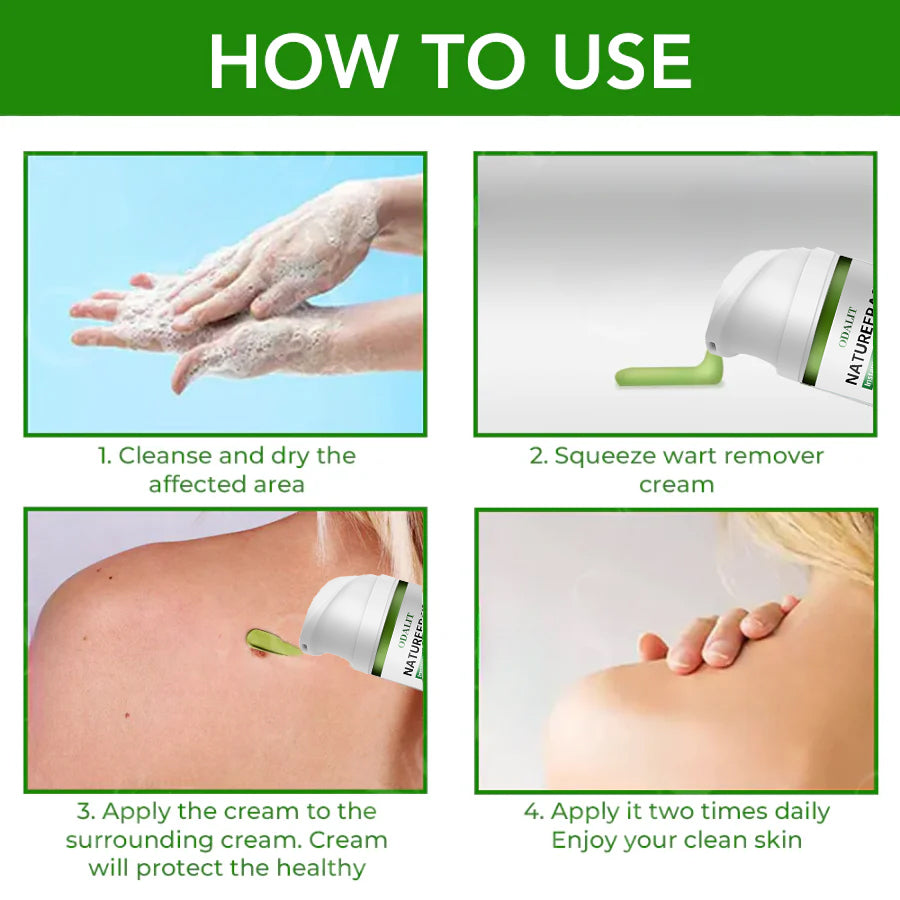 🔥Final 3 Hours: 80% OFF - ODALIT™ NatureErase Instant Mole & Spot Cream