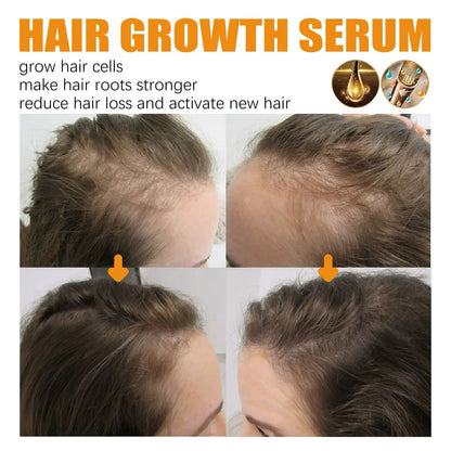 ODALIT™ Biotin Hair Growth Serum