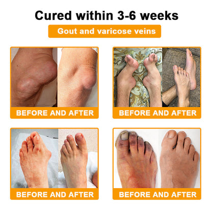 🔥Final 3 Hours: 80% OFF - ODALIT™ Botulinum Toxin & Bee Venom Pain-Relief Bone Healing Cream🐝