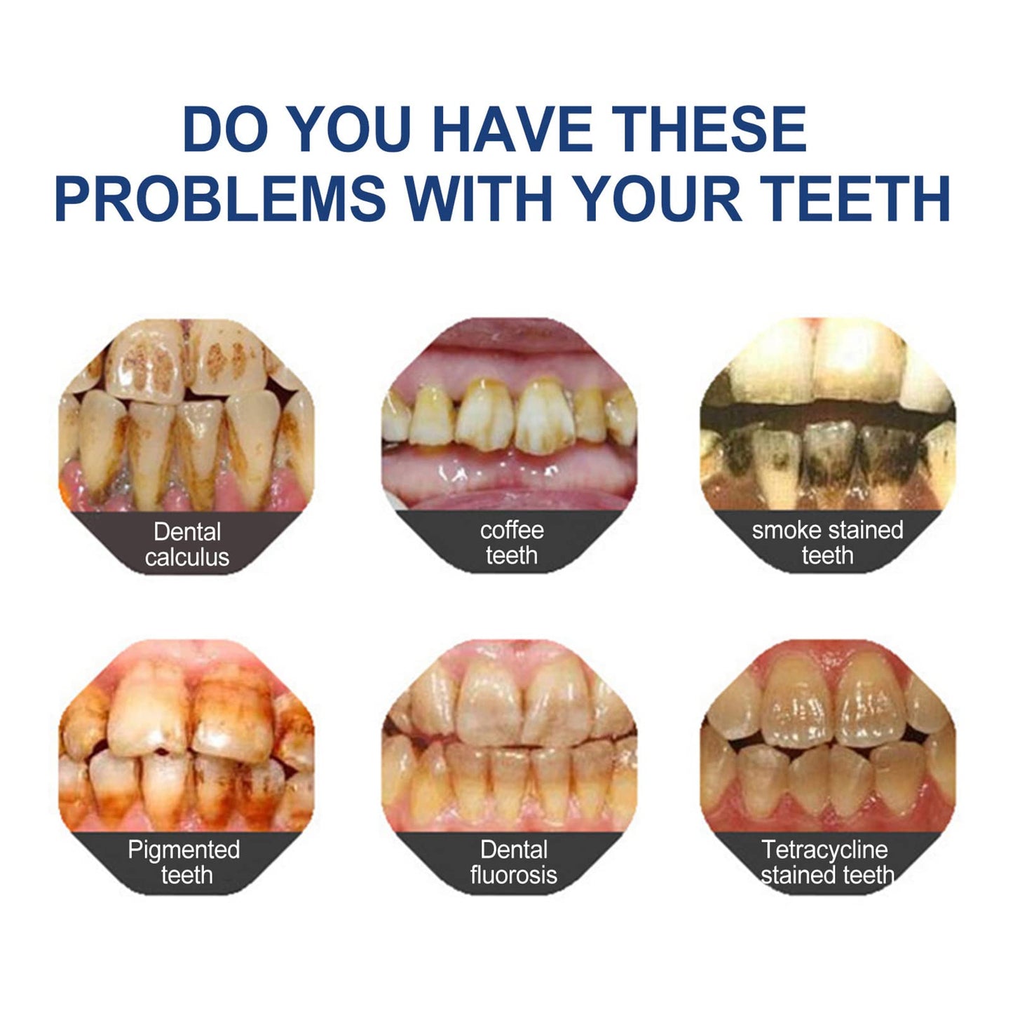 🔥Final 3 Hours: 80% OFF - ODALIT™ Fluoride-Free Nano-Hydroxyapatite Toothpaste