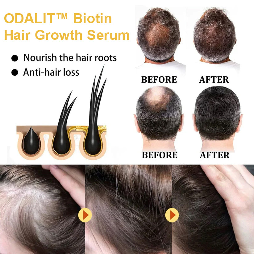 ODALIT™ Biotin Hair Growth Serum