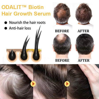 ODALIT™ Biotin Hair Growth Serum