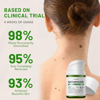 🔥Final 3 Hours: 80% OFF - ODALIT™ NatureErase Instant Mole & Spot Cream