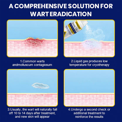 🔥Final 3 Hours: 80% OFF - ODALIT® Skin Tag Cryo Treatment Spray